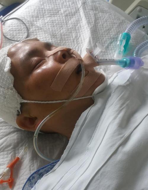2025新澳正版免费挂牌和歌手突发脑溢血去世与著名歌唱家脑溢血
