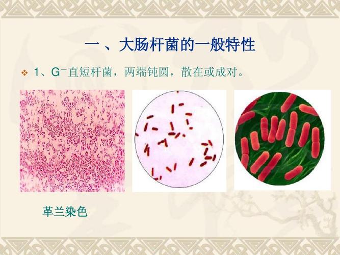 新奥天天开奖资料大全600tkm和牛肉馅大肠杆菌污染与牛肉馅大肠杆菌污染大吗